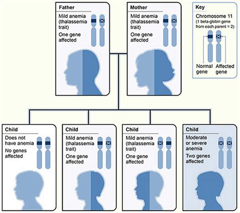 beta thalassemia major